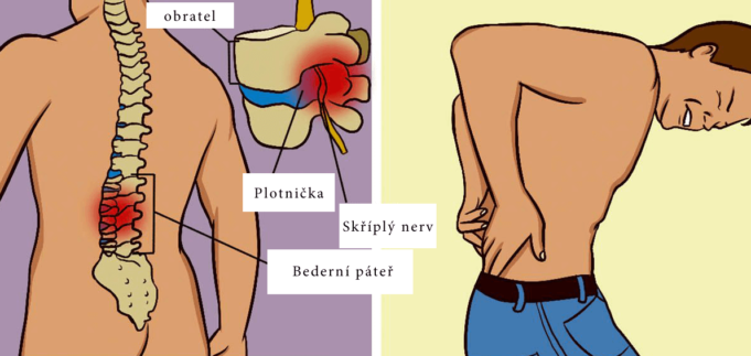 Jak_se_dá_zjistit_vyhozená_ploténka_a_co_s_tím_dělat