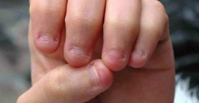 520