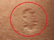 Znáte skutečnou pravdu skrývající se za malou jizvou na horní levé paži, a její skutečný význam?