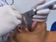 24letý mladík nedokázal popadnout dech. Bylo neuvěřitelné, co mu lékaři vytáhli z krku