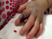 Křičící malá holčička vešla z hřiště, když její matka uviděla její ruku, byla šokovaná!