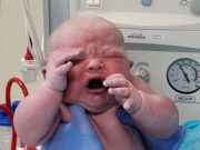 Šok na porodním sále, ani lékaři takového novorozence neviděli. „Stal se malou celebritou“