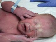 Lékaři si mysleli, že se narodilo zdravé dítě, ale když se podívali na pupeční šňůru, uvědomili si situaci