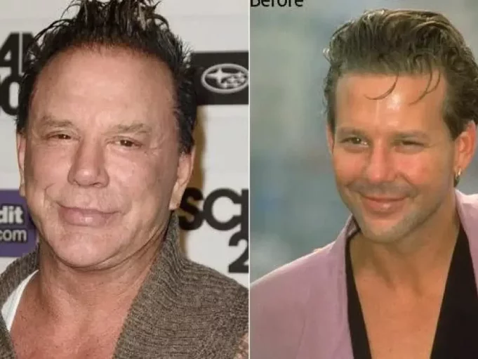 Mickey Rourke (1)